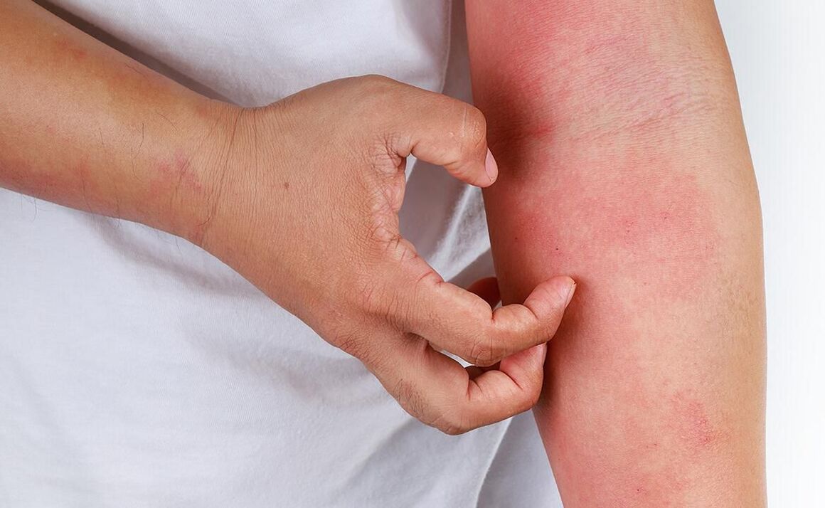 سوڈا کے استعمال سے ممکنہ پیچیدگیاں